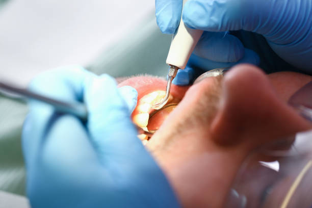 Best Tooth Infection Emergency Dentist  in Ronceverte, WV