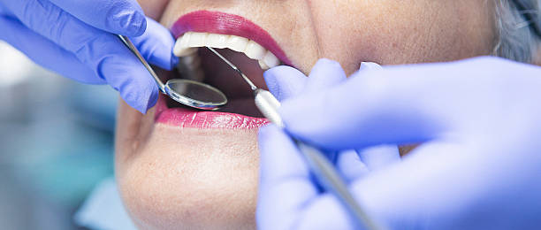 Emergency Dental Filling Replacement in WV